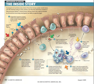 What Causes Leaky Gut - Amanda Naturally